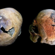 Skulls exhibiting fractures consistent with an exploding brain.